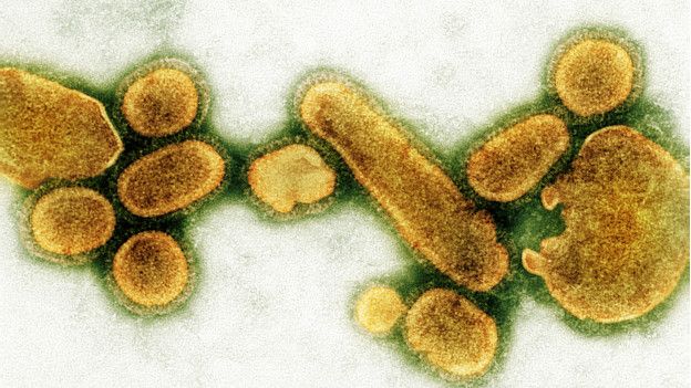 O vírus da gripe espanhola visto no microscópio
