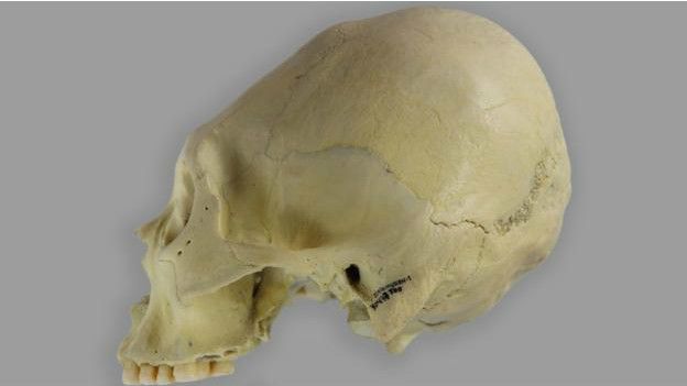 Un cráneo deformado de Patagonia