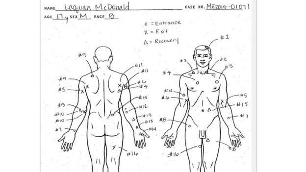Autopsia de McDonald