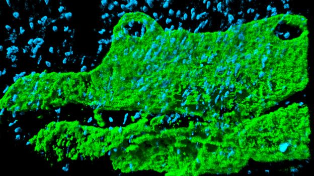 Imagen 3D de microscopía confocal de un tejido inflamado que muestra los vasos linfáticos, de Samantha Arokiasamy 