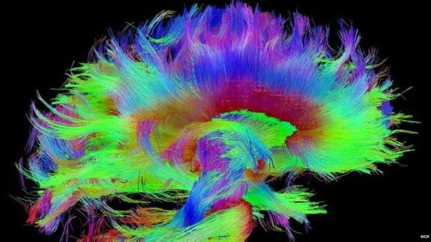 Sistema del cerebro humano 