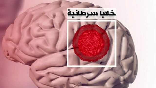 صورة توضيحية للدماغ