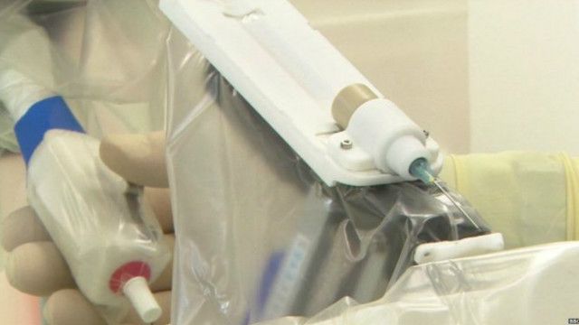 robot eye operation