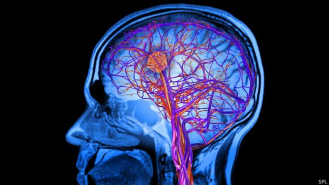 Imagen de una cabeza y el cerebro