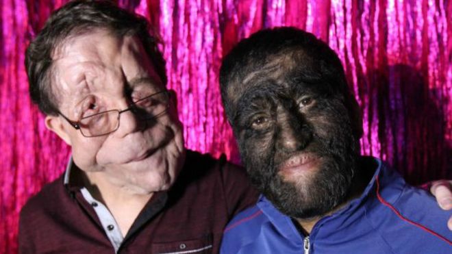 Adam Pearson y Jesús Aceves