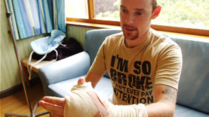 Cuando Un Dedo Gordo Del Pie Reemplaza Un Pulgar Bbc News Mundo