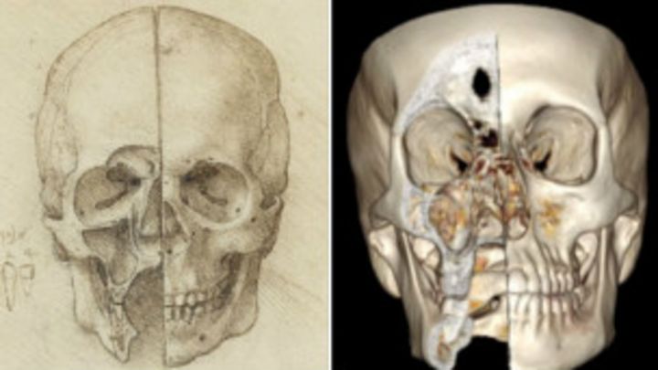 Naskolko Tochny Anatomicheskie Risunki Leonardo Da Vinchi Bbc