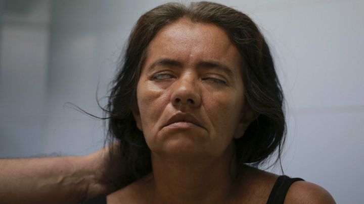 Que Los Enfermedad El Otra Es Qué BarréLa Guillain Científicos wnP08Ok