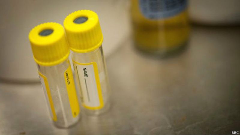Recipientes para muestras de laboratorio