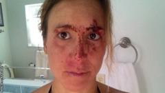 Mercedes Maidana covered in blood after her accident