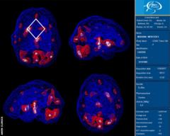 Scan of Mercedes Maidana's brain