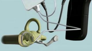 Hear a simulation of what a cochlear implant sounds like - CBBC Newsround