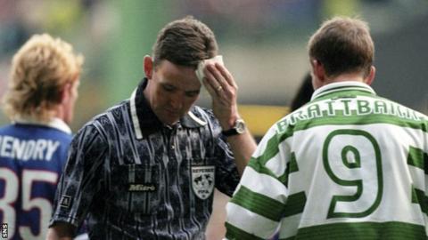 Referee Hugh Dallas mops up blood after being hit on the head by a coin in an Old Firm match in 1999