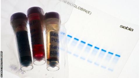 Blood doping samples