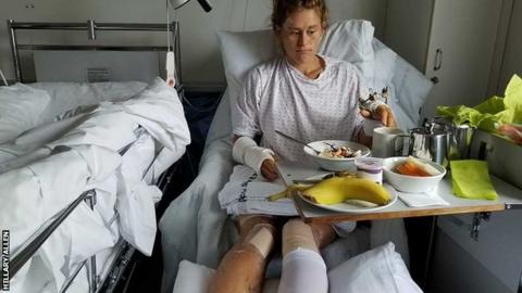 Hillary Allen in her hospital bed in Tromso