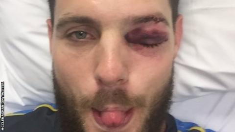 Mitchell McClenaghan