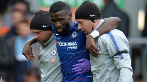 Maurizio Sarri belittles both Liverpool and Spurs’ Champions League runs: Here’s why