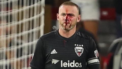 A bloodied Wayne Rooney