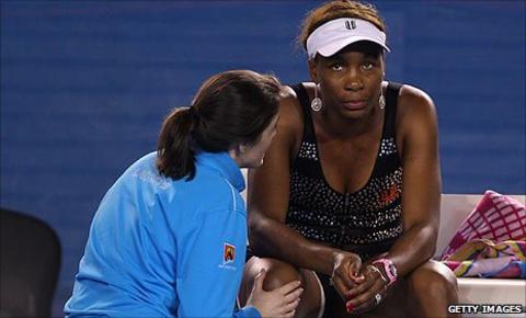 Venus Williams