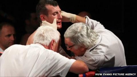 Derry Matthews is examined by medical staff