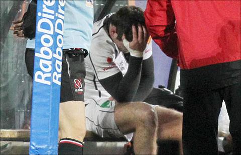The injured Jared Payne on the Ulster bench