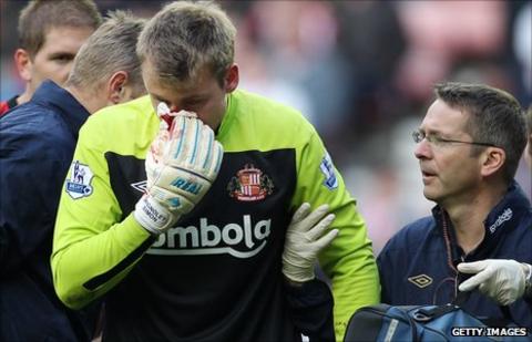 Simon Mignolet