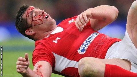 Huw Bennett