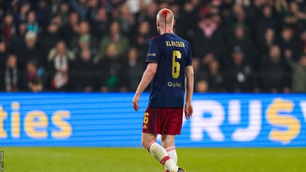 Davy Klaassen is pictured from behind with blood pouring from his head