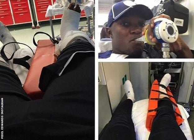Fidel Edwards Instagram post on leg break