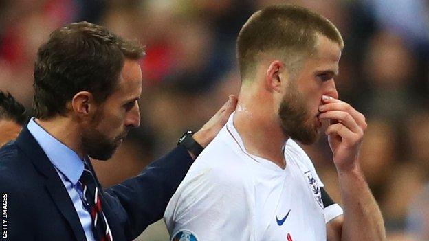Eric Dier injured in England's win over the Czech Republic