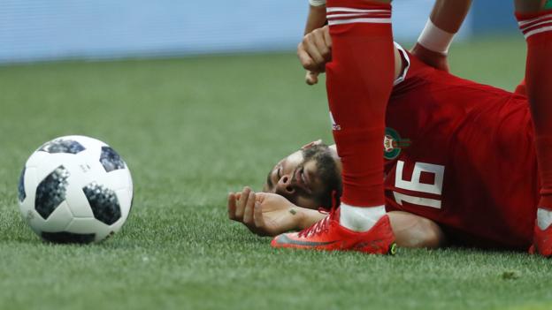 Uefa: Football needs new concussion protocols