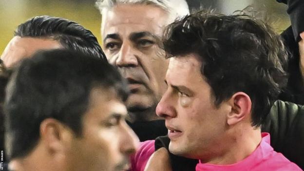 Referee Halil Umut Meler's face swells after Faruk Koca, President of MKE Ankaragucu throws a punch to him following the Turkish Super Lig week 15 football match between MKE Ankaragucu and Rizespor at Eryaman Stadium in Ankara