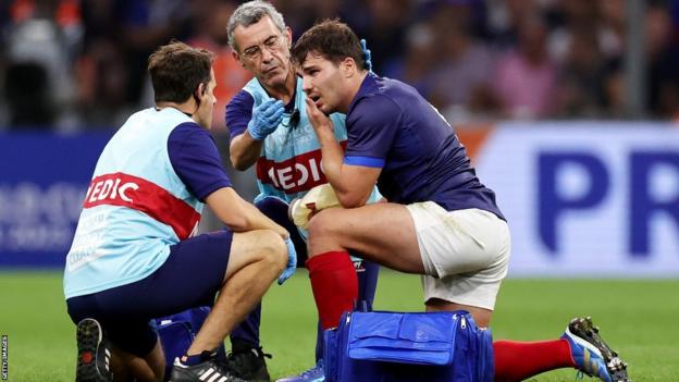 Antoine Dupont after suffering a fractured cheekbone in France's Rugby World Cup victory over Namibia