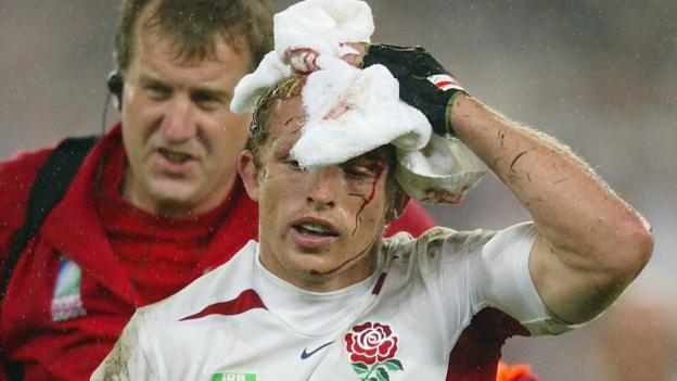 'Mum couldn't stand watching me play' - Dawson on concussion and its consequences thumbnail