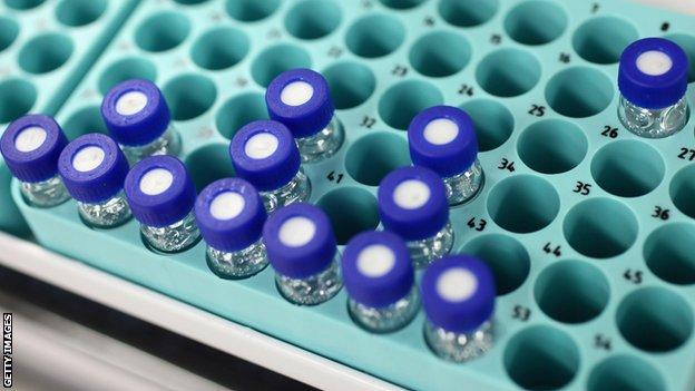 Samples in an anti-doping laboratory