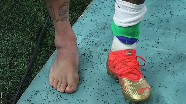 FIFA World Cup 2022  Neymar shows swollen ankle, plans to return at World  Cup - The Hindu