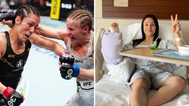 Alexa Grasso and Valentina Shevchenko both punch each other beside a picture of her in a hospital bed with her arm in a cast after surgery