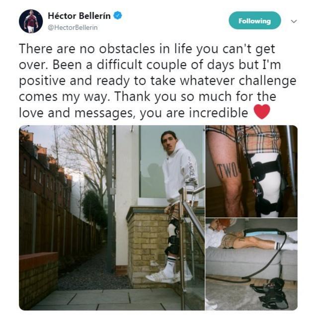 Hector Bellerin: The B's Knee, Page 70