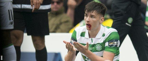 Celtic's Kieran Tierney suffers a mouth injury