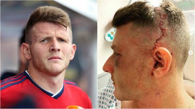 Sam Ward: GB & England player still 'dreams' of Tokyo 2020 despite 'freak' eye injury