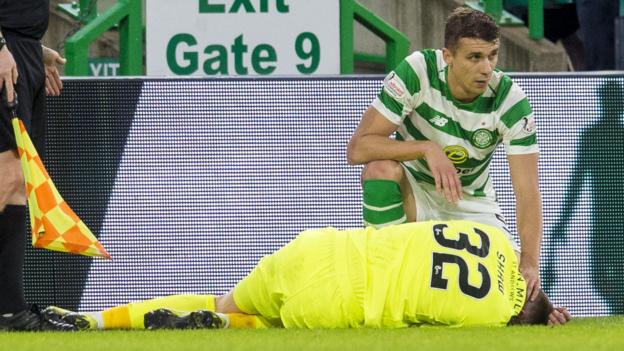 Rodgers has ‘no concerns’ over Simunovic tackle