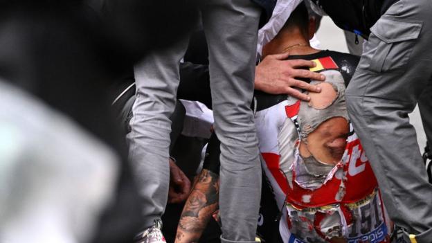 Cyclist Caleb Ewan aft  the 2021 crash