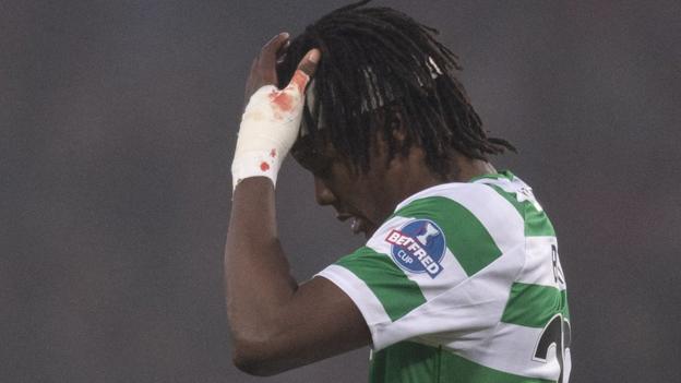 Celtic’s Boyata a major doubt for Salzburg tie