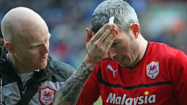 Cardiff City defender Kevin McNaughton leaves the pitch after suffering a cut to the head.