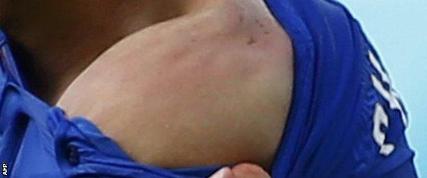 Giorgio Chiellini of Italy displays his shoulder after the bite by Luis Suarez