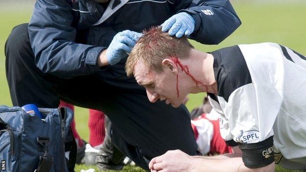 Dr Willie Stewart says more care needs to be taken with players who receive a head injury.
