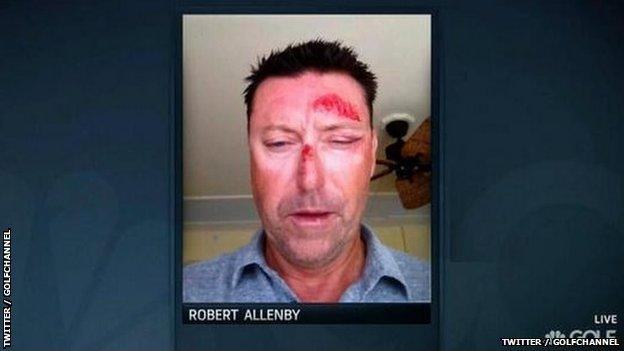 A Golf Channel picture of injured Robert Allenby