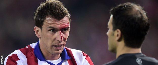 Mario Mandzukic with blood on his face