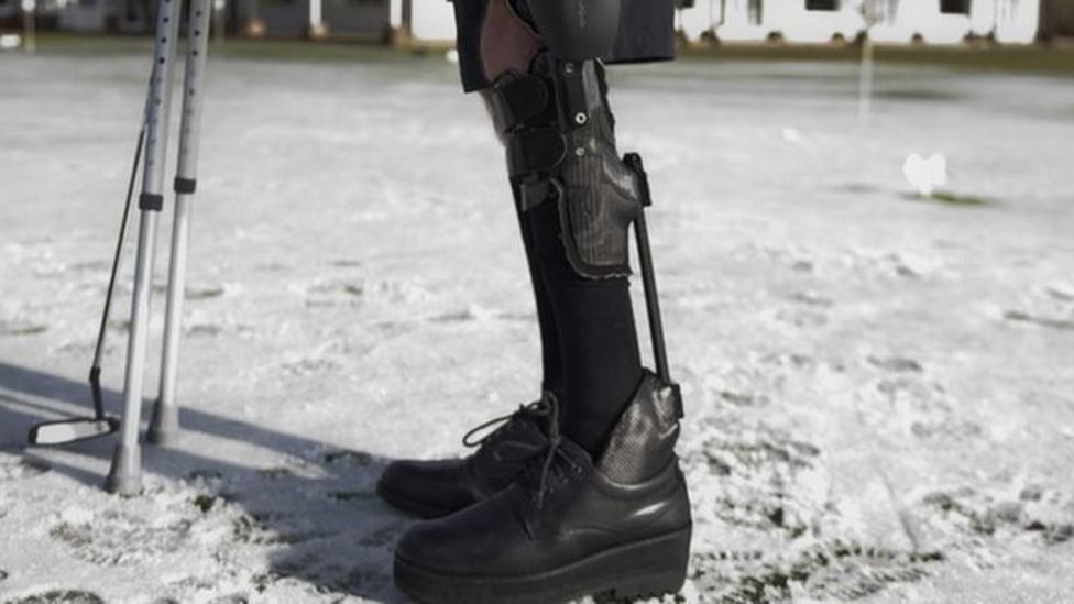 First Brit With Bionic Leg Brace - CBBC Newsround