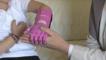 Vea en acción la mano impresa en 3D para una niña de 5 años